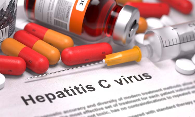 Hepatitis C